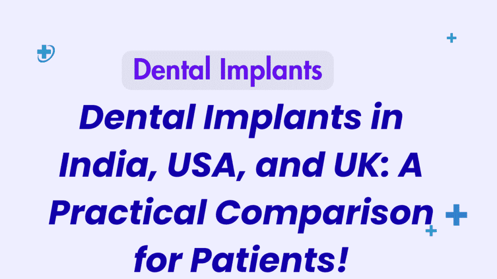 Dental-Implants