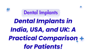 Dental-Implants