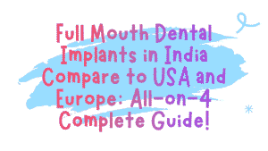 Full Mouth Dental Implants in India Compare to USA and Europe: All-on-4 Complete Guide 9 Dental Implants in India