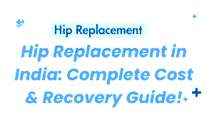 Hip-Replacement